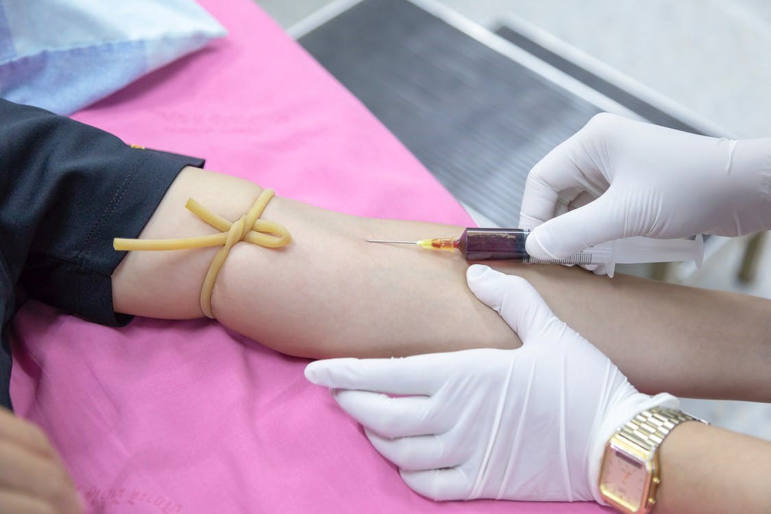procalcitonin in sepsis
