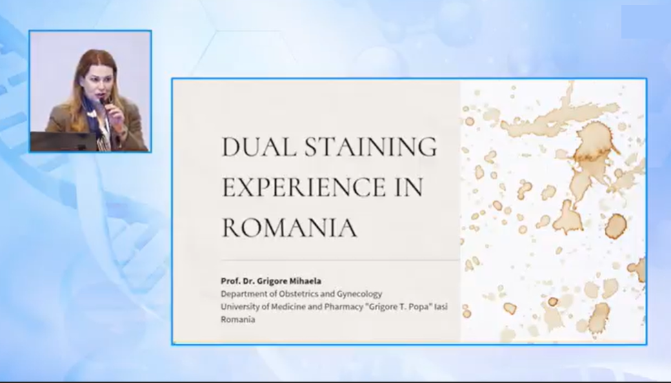 cervical cancer, cervical cancer screening, p16/ki67 dual stain