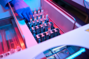 Small labs, big potential: applying automation beyond high-volume sites 14 benefits of lab automation