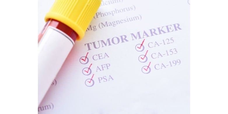 Serum tumour markers and the future of cancer diagnostics: China's viewpoint from the clinic and the lab