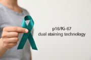 Advancing women’s health: p16/Ki-67 dual staining technology improves cervical cancer diagnostics