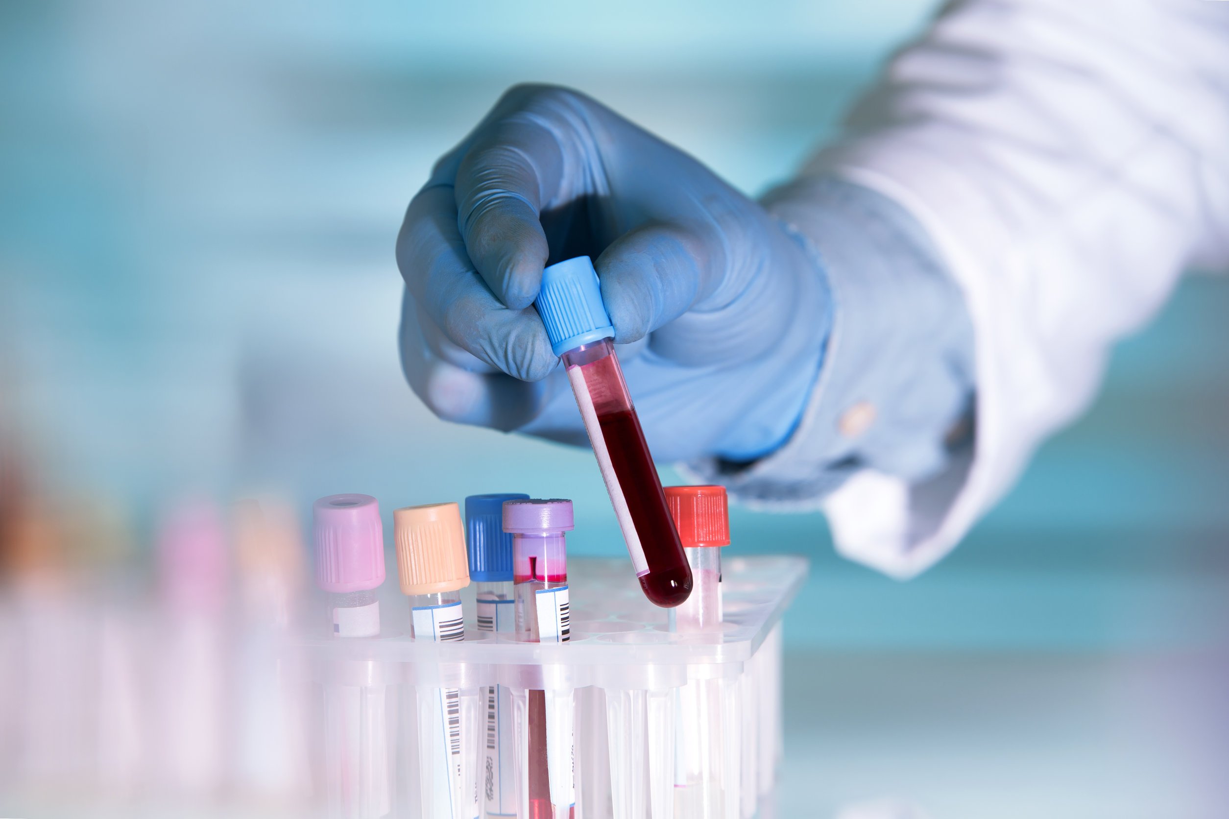 Haemophilia diagnostics and therapeutics: a brief introduction