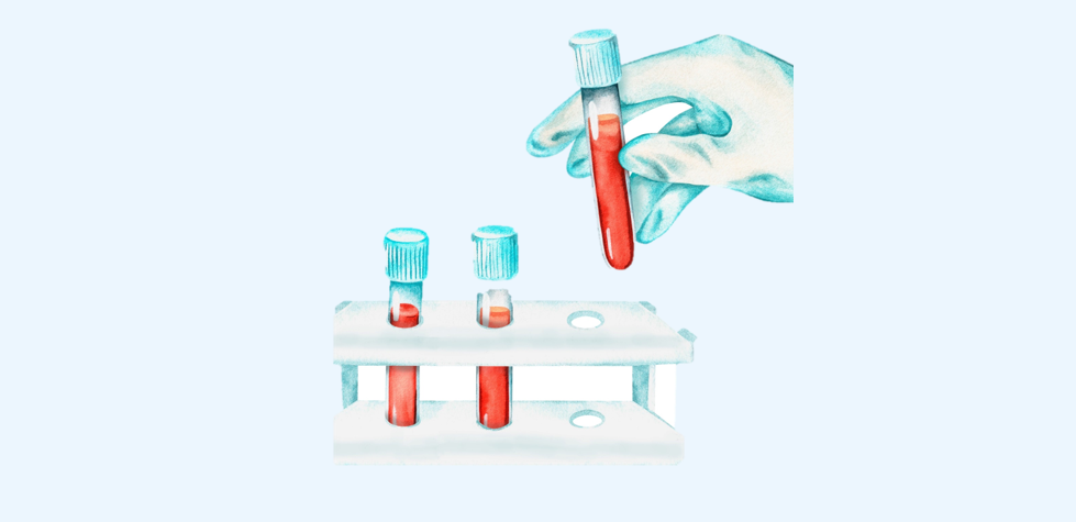 Biomarkers in cancer-associated thrombosis: insights from Prof Anna Falanga and Cinzia Giaccherini