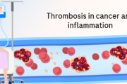 Thrombosis in cancer and inflammation: insights from Prof Ng Heng Joo