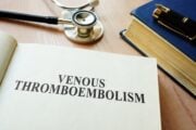 Venous thromboembolism (VTE) in Asia: risk factors, diagnosis and treatment