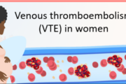 Venous thromboembolism (VTE) in women: incidence, risk factors and treatment