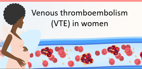 Venous thromboembolism (VTE) in women: incidence, risk factors and treatment