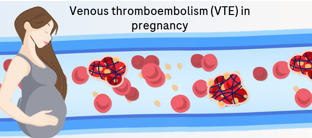 VTE associated with hormone therapy and pregnancy - Assoc Prof Lai Heng Lee on risk and management_thumbnail