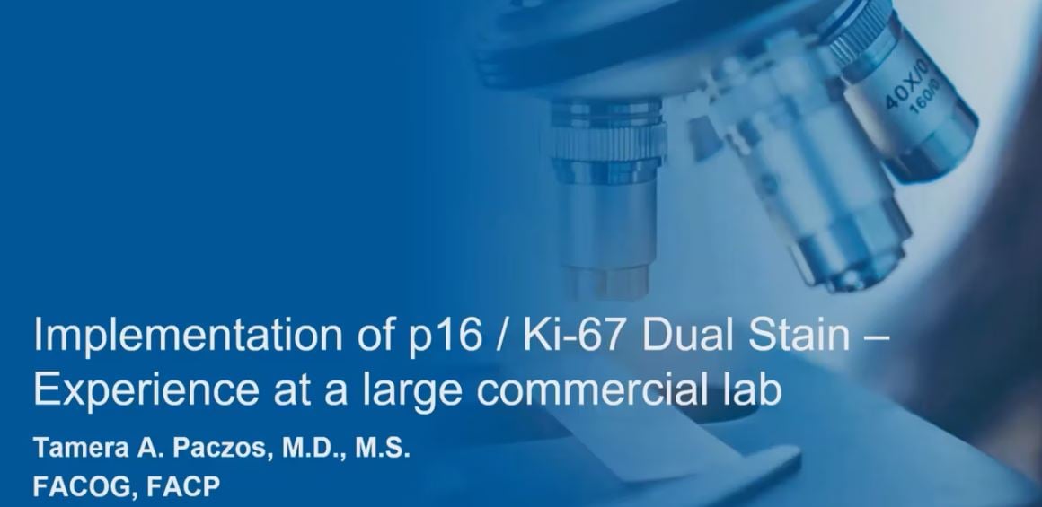 Implementing p16/ki67 dual stain at a large US commercial lab: Dr Tamera Paczos