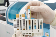 Boosting your lab’s processes: discover the benefits of third-party quality controls