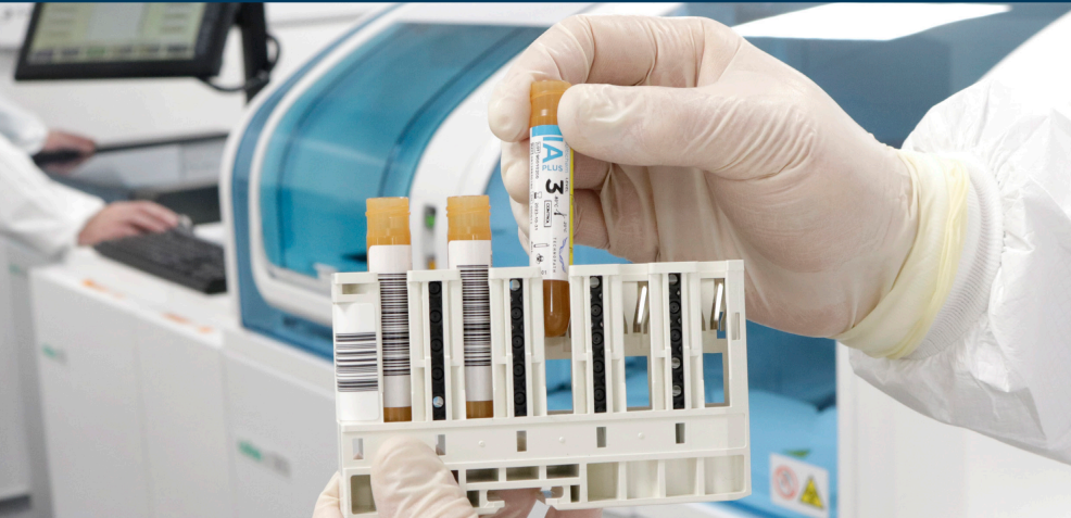 Boosting your lab’s processes: discover the benefits of third-party quality controls